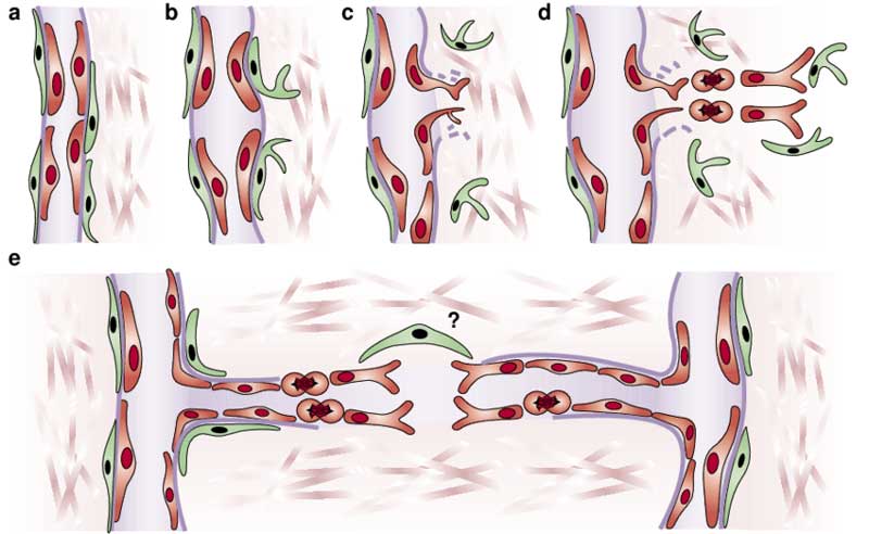 New-blood-vessel-formation