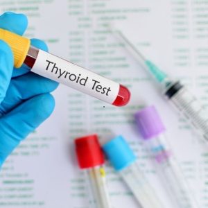 Hormone And Thyroid Testing