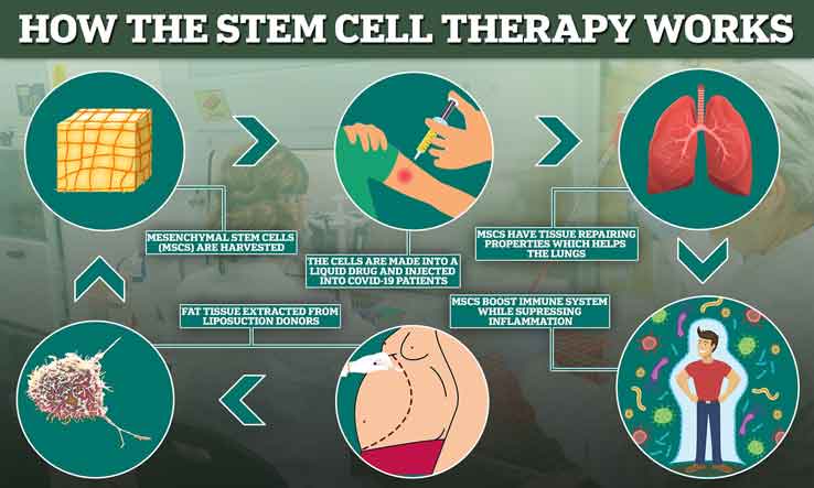 how-does-palm-beach-stem-cell-therapy-work